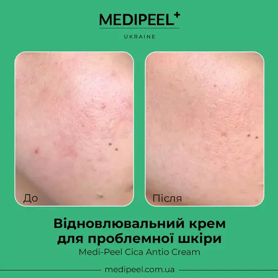 Medi Peel Cica Antio Cream