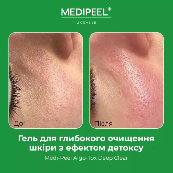 Medi Peel Algo-Tox Deep Clear