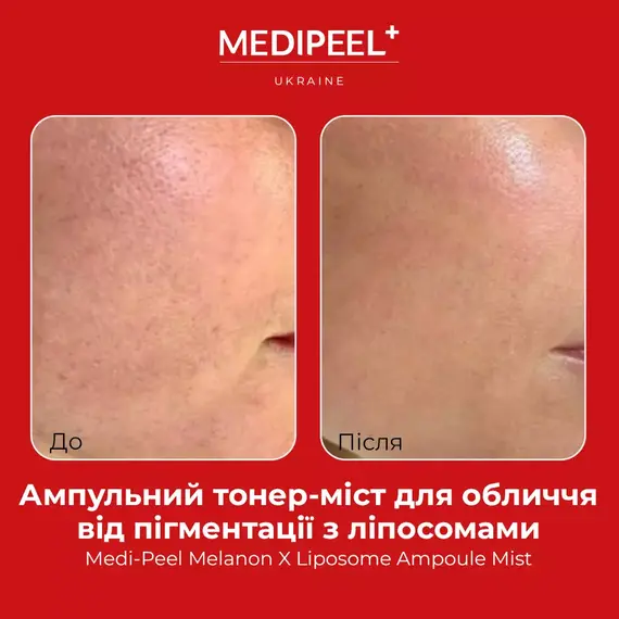 Medi-Peel Melanon X Liposome Ampoule Mist