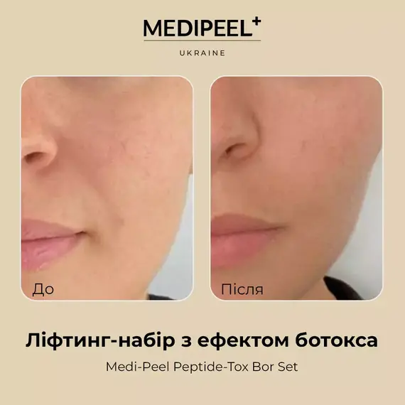Medi Peel Peptide-Tox Bor Set (Bor-Tox Peptide Set)