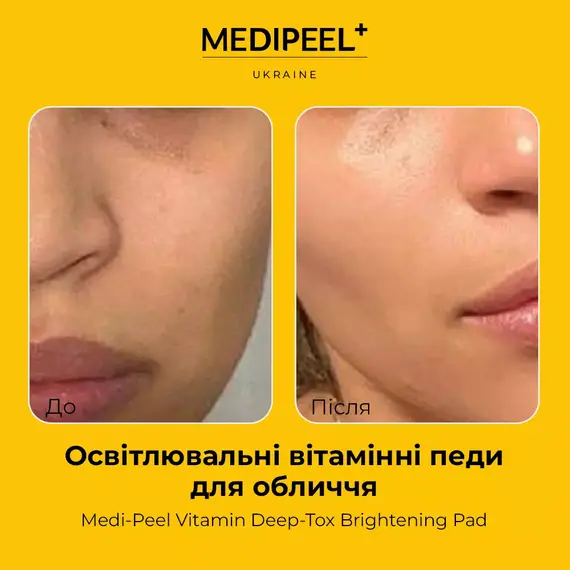 Medi-Peel Vitamin Deep-Tox Brightening Pad