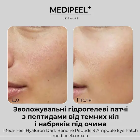 Medi-Peel Hyaluron Dark Benone Peptide 9 Ampoule Eye Patch