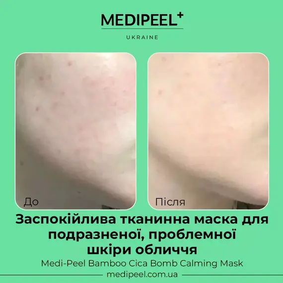 Medi-Peel Bamboo Cica Bomb Calming Mask