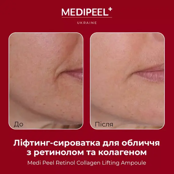 Medi-Peel Retinol Collagen Lifting Ampoule