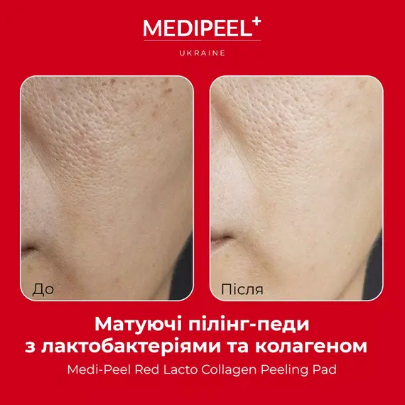 Medi-Peel Red Lacto Collagen Peeling Pad