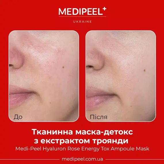 Medi-Peel Hyaluron Rose Energy Tox Ampoule Mask
