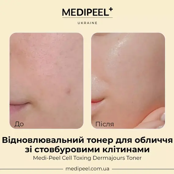 Medi-Peel Cell Toxing Dermajours Toner