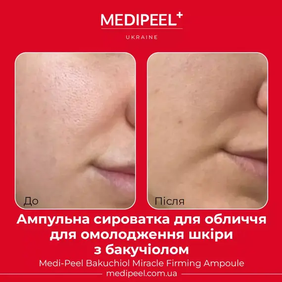 Medi-Peel Bakuchiol Miracle Firming Ampoule