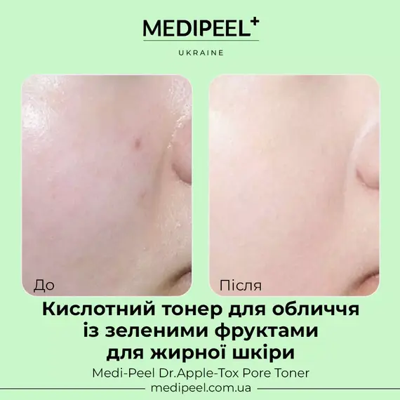 Medi-Peel Dr.Apple-Tox Pore Toner
