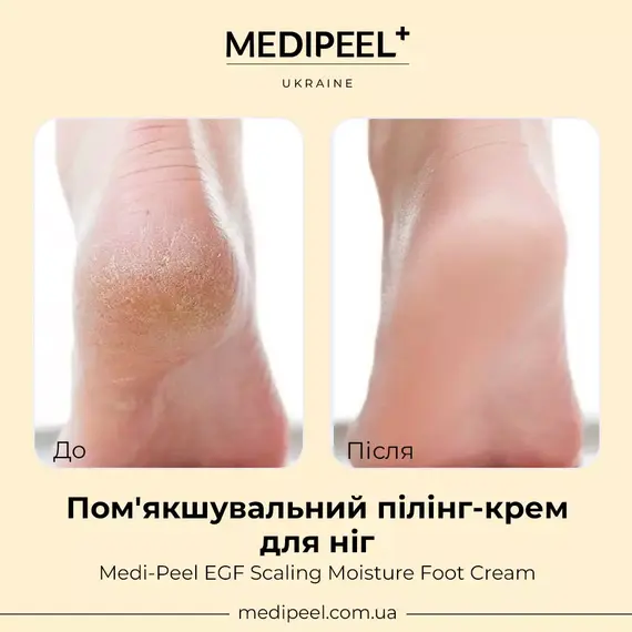 Medi-Peel EGF Scaling Moisture Foot Cream