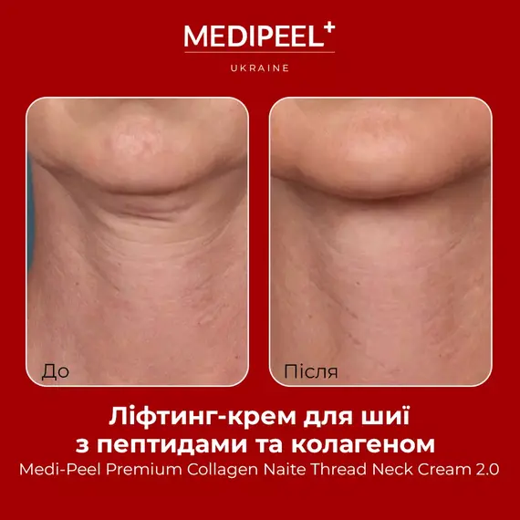 Medi Peel Premium Collagen Naite Thread Neck Cream 2.0