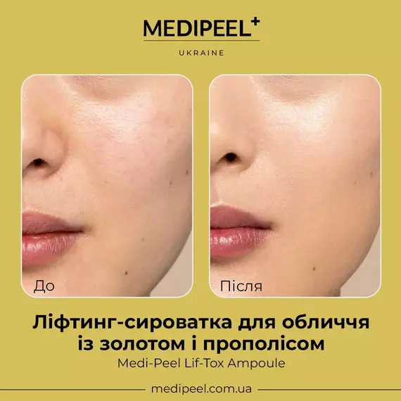 Medi-Peel Lif-Tox Ampoule