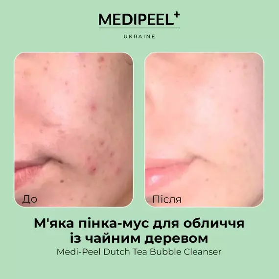 Medi-Peel Dutch Tea Bubble Cleanser