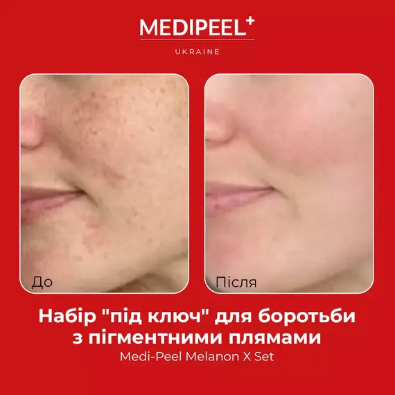 Medi-Peel Melanon X Set