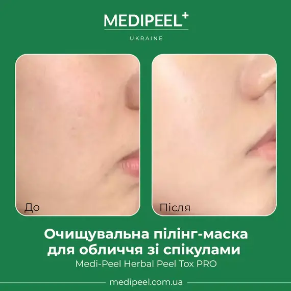 Medi-Peel Herbal Peel Tox PRO