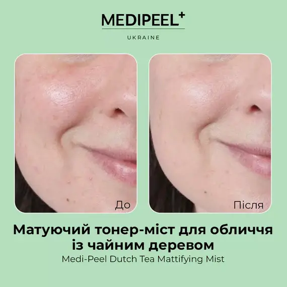 Medi-Peel Dutch Tea Mattifying Mist