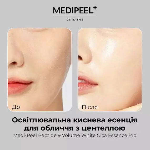 Medi-Peel Peptide 9 Volume White Cica Essence Pro