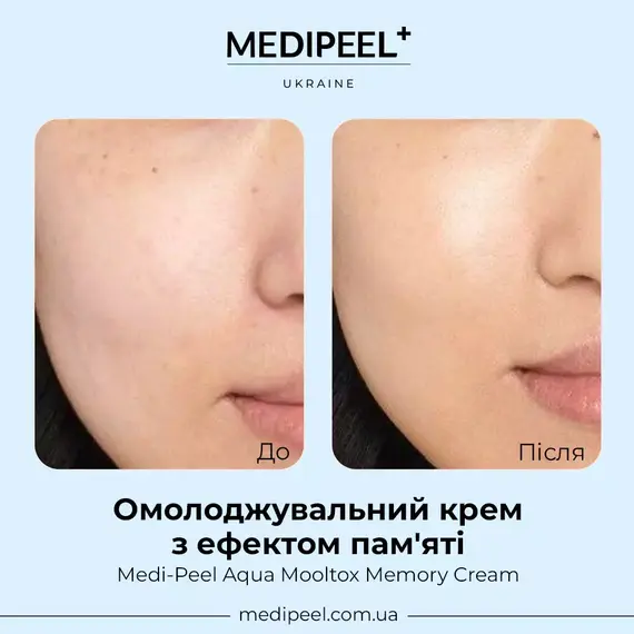 Medi Peel Aqua Mooltox Memory Cream