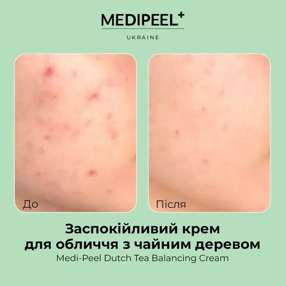 Medi-Peel Dutch Tea Balancing Cream