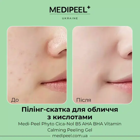 Medi Peel Phyto Cica-Nol B5 AHA BHA Vitamin Calming Peeling Gel