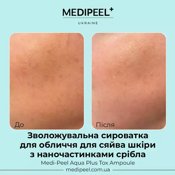 Medi-Peel Aqua Plus Tox Ampoule