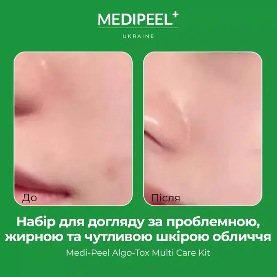 Medi-Peel Algo-Tox Multi Care Kit