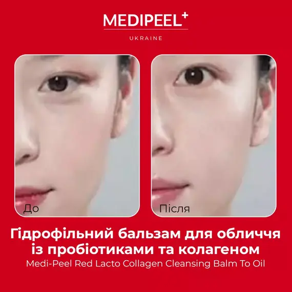 Medi-Peel Red Lacto Collagen Cleansing Balm To Oil