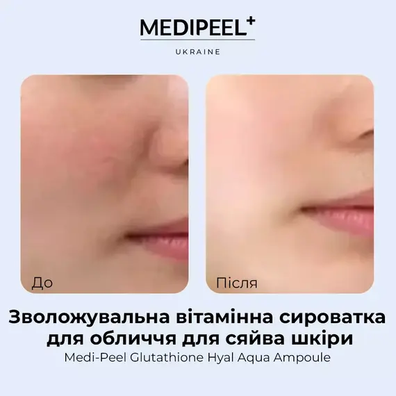 Medi Peel Glutathione Hyal Aqua Ampoule
