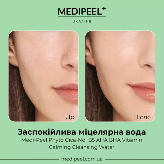Medi Peel Phyto Cica-Nol B5 AHA BHA Vitamin Calming Cleansing Water