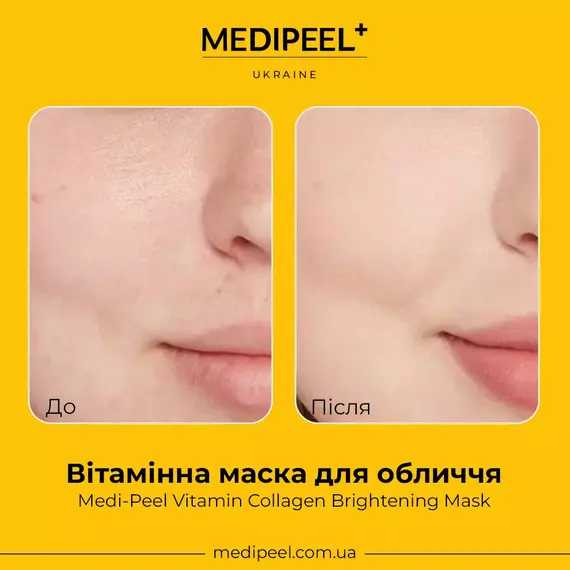 MEDIPEEL Vitamin Collagen Brightening Mask