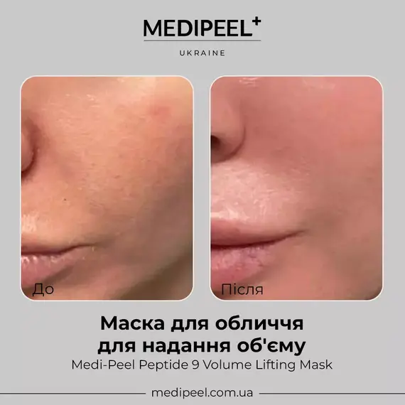 MEDIPEEL Peptide 9 Volume Lifting Mask