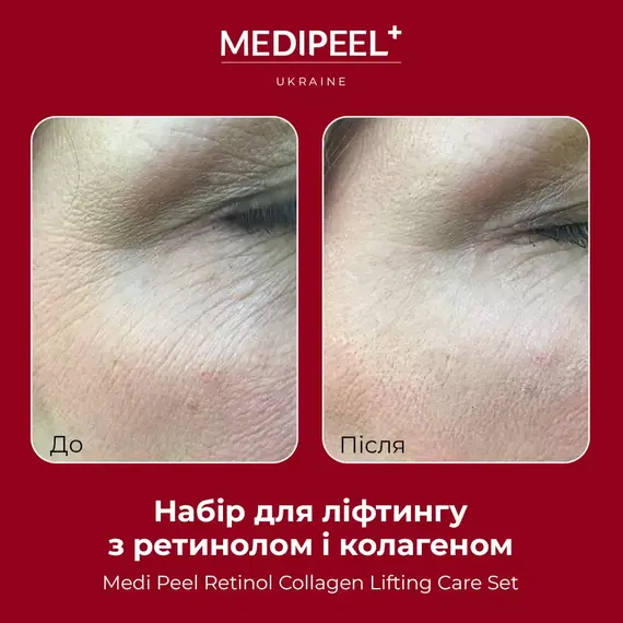 Medi-Peel Retinol Collagen Lifting Care Set
