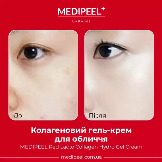 MEDIPEEL Red Lacto Collagen Hydro Gel Cream
