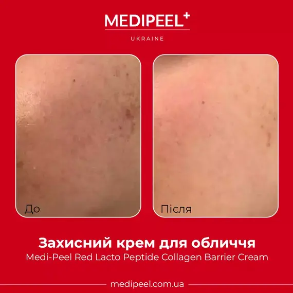 Medi-Peel Red Lacto Peptide Collagen Barrier Cream