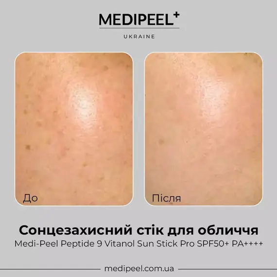 Medi-Peel Peptide 9 Vitanol Sun Stick Pro SPF50+ PA++++