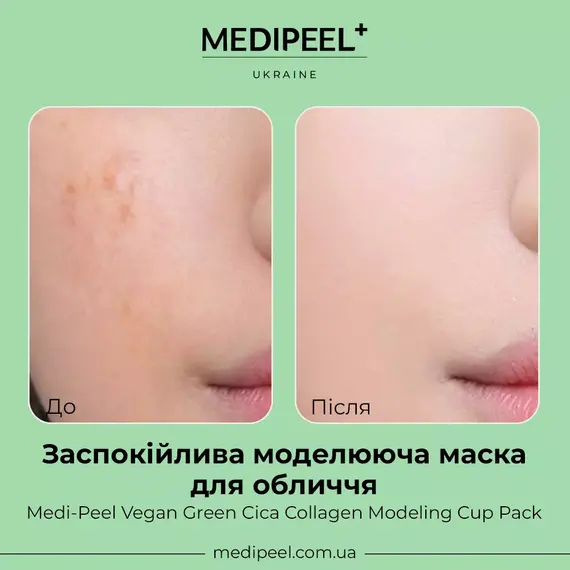 Medi-Peel Vegan Green Cica Collagen Modeling Cup Pack