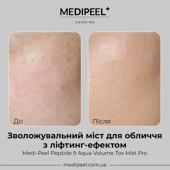 Medi-Peel Peptide 9 Aqua Volume Tox Mist ProMedi-Peel Peptide 9 Aqua Volume Tox Mist ProMedi-Peel Peptide 9 Aqua Volume Tox Mist Pro