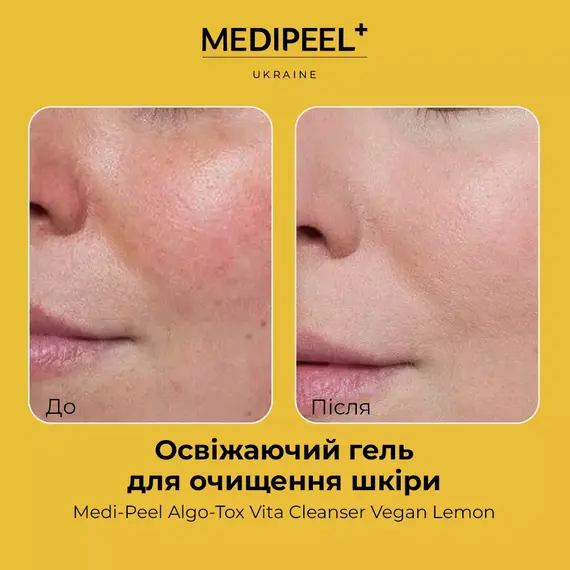 Medi Peel Algo-Tox Vita Cleanser Vegan Lemon