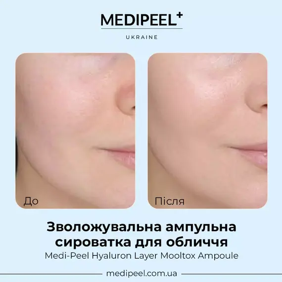Medi-Peel Hyaluron Layer Mooltox Ampoule
