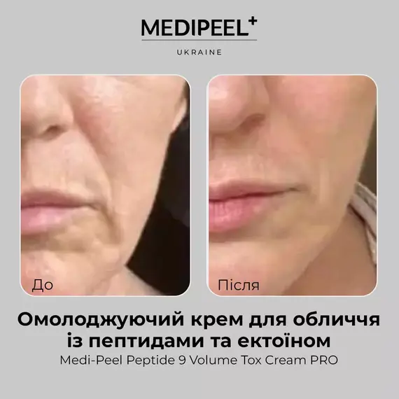 MEDI-PEEL Peptide 9 Volume Tox Cream PRO