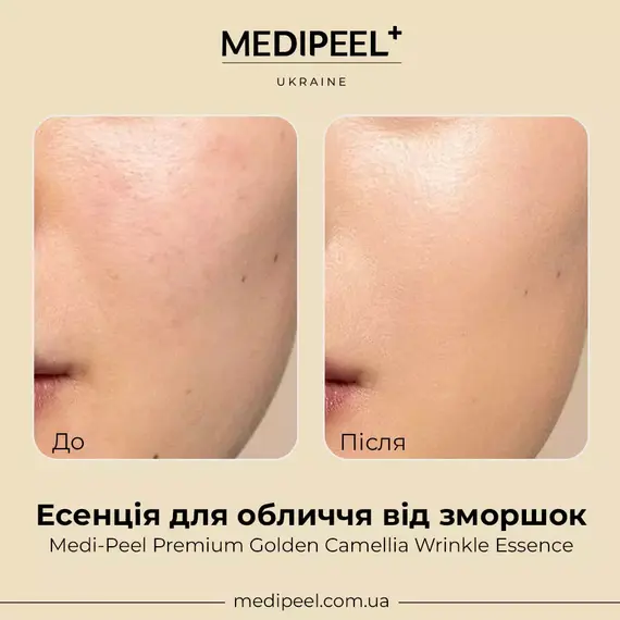 Medi-Peel Premium Golden Camellia Wrinkle Essence