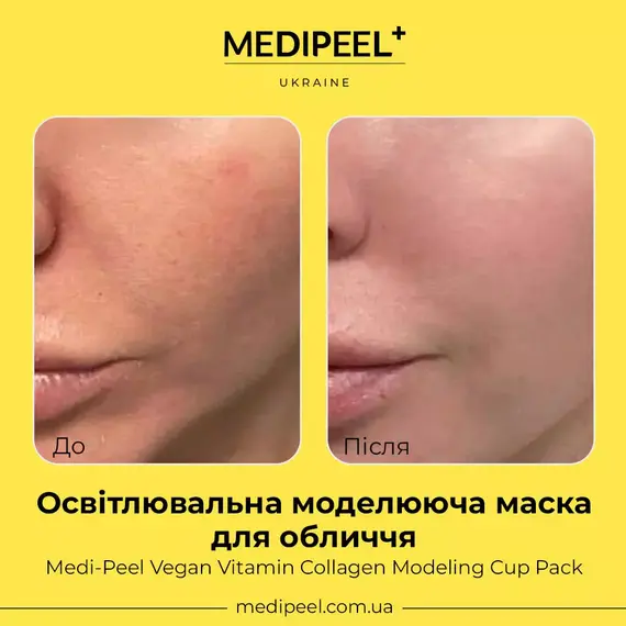 Medi-Peel Vegan Vitamin Collagen Modeling Cup Pack
