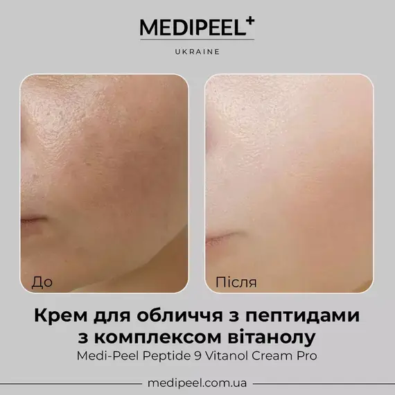 Medi-Peel Peptide 9 Vitanol Cream Pro