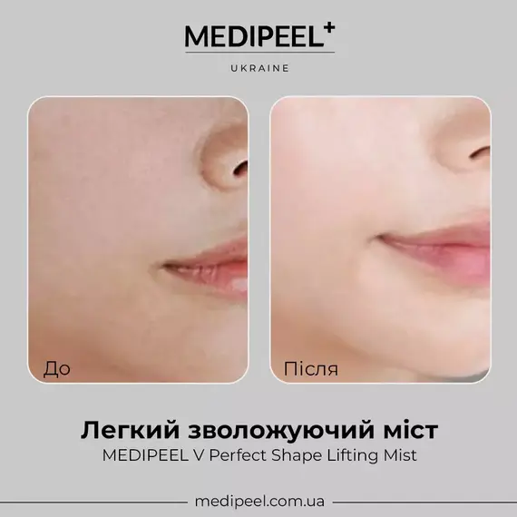 MEDIPEEL V Perfect Shape Lifting Mist