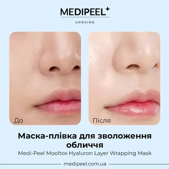 Medi-Peel Mooltox Hyaluron Layer Wrapping Mask