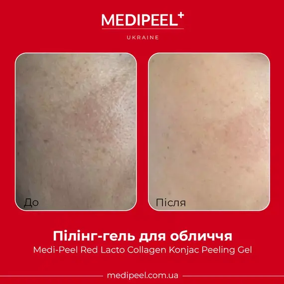 Medi-Peel Red Lacto Collagen Konjac Peeling Gel