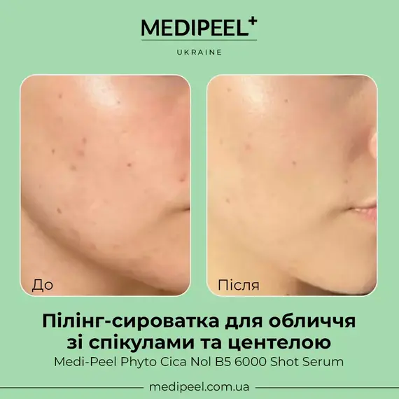 MEDIPEEL Phyto Cica Nol B5 6000 Shot Serum