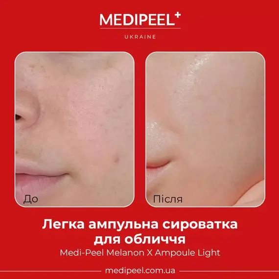 Medi-Peel Melanon X Ampoule Light