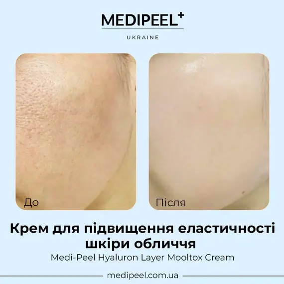 Medi-Peel Hyaluron Layer Mooltox Cream