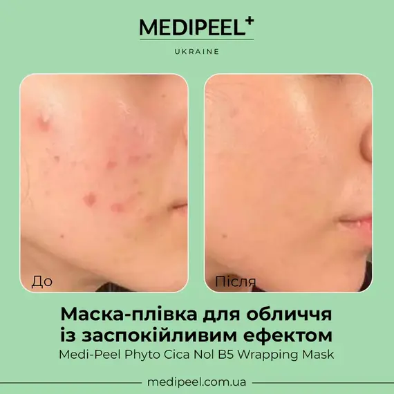 Medi-Peel Phyto Cica Nol B5 Wrapping Mask
